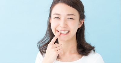 ホワイトニング